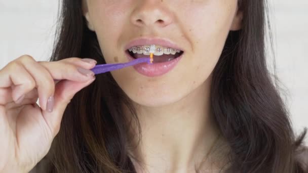 Higiene oral para aparatos ortopédicos. La joven con aparatos dentales se limpia los dientes. Chica adolescente limpiando y cepillando dientes con frenos de cerámica transparente usando herramientas especiales de cepillado . — Vídeos de Stock