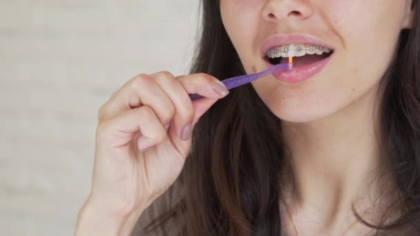 Igiene orale per bretelle. Giovane ragazza con l'apparecchio dentale pulisce i denti. Teen ragazza pulizia e spazzolatura dei denti con bretelle in ceramica trasparente utilizzando speciali strumenti di spazzolatura . — Video Stock