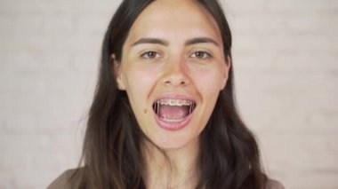 kişi, ifade ve duygu kavramı - mutlu gülümseyen genç kadın diş teli ile