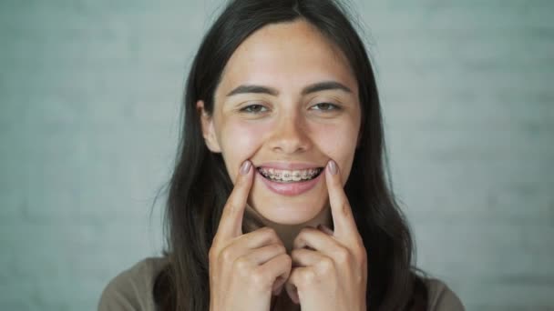 A fogak fogszabályozó. A lány mosolyog, mutatja a nadrágtartó, a fogát. Fehér és egészséges fogazat — Stock videók