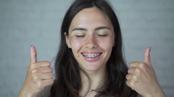 La ragazza porta l'apparecchio ai denti. fastidio, dolore — Video Stock