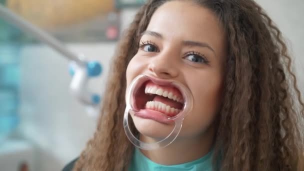 Profesjonalne Wybielanie zębów kosmetyczne. — Wideo stockowe