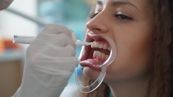 Profesyonel kozmetik diş beyazlatma. — Stok video