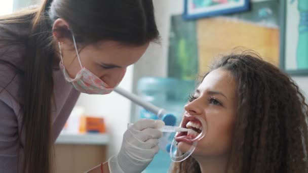 Blanqueamiento dental cosmético profesional . — Vídeos de Stock