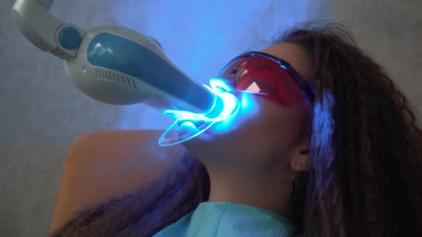 Blanchiment professionnel des dents cosmétiques . — Video