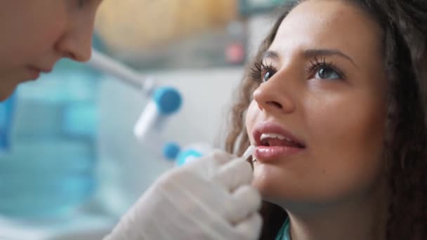 Clareamento profissional dos dentes cosméticos . — Vídeo de Stock