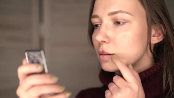 Herpes on the lips, part of a womans face with finger on lips with herpes, beauty concept — Stock Video