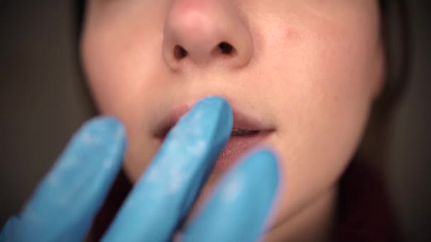 Herpes en los labios, parte de una cara de mujer con el dedo en los labios con herpes, concepto de belleza — Vídeos de Stock