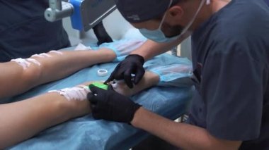 Bir doktor varis ve örümcek damarlarını yoketmek için kullanılan tıbbi prosedürleri uygular. Solüsyonun doğrudan damara enjekte edilmesi..