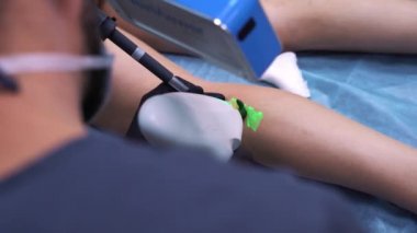 Skleroterapi, bazen varis ve venöz malformasyonların tedavisinde kullanılan yöntemlerden biridir. V aricose, sclerotherapy ve ven izleyicisi