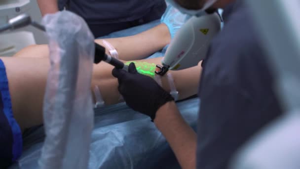 Een arts doet een medische procedure Sclerotherapie gebruikt om spataderen en spinnen aderen te elimineren. Een injectie van een oplossing rechtstreeks in de ader. — Stockvideo