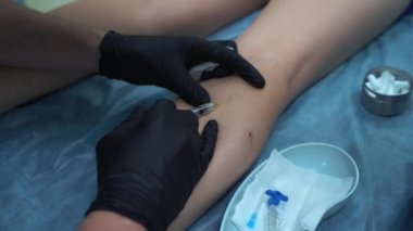 Bir doktor varis ve örümcek damarlarını yoketmek için kullanılan tıbbi prosedürleri uygular. Solüsyonun doğrudan damara enjekte edilmesi..