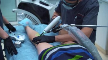 Bir doktor varis ve örümcek damarlarını yoketmek için kullanılan tıbbi prosedürleri uygular. Solüsyonun doğrudan damara enjekte edilmesi..