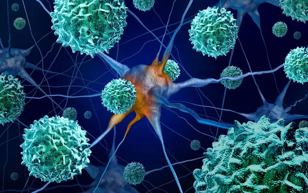 Afm 病や急性弛緩性脊髄炎 イラストレーションとしてエンテロ ウイルスやポリオ ウイルスを表す神経学的条件として医療コンセプト — ストック写真