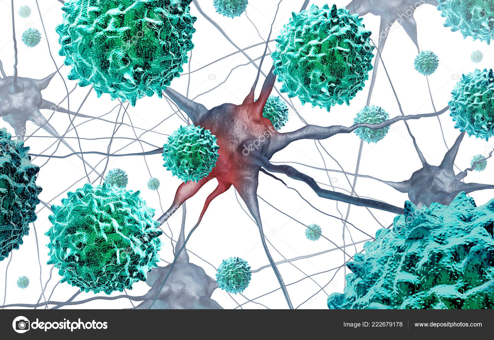 Polio Afm Disease Acute Flaccid Myelitis Medical Concept Neurologic