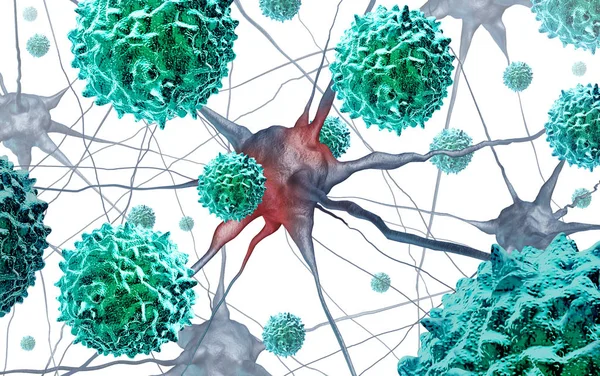 Afm 배경에 일러스트로 엔테로바이러스 바이러스 질병을 나타내는 신경학 조건으로 소아마비 — 스톡 사진