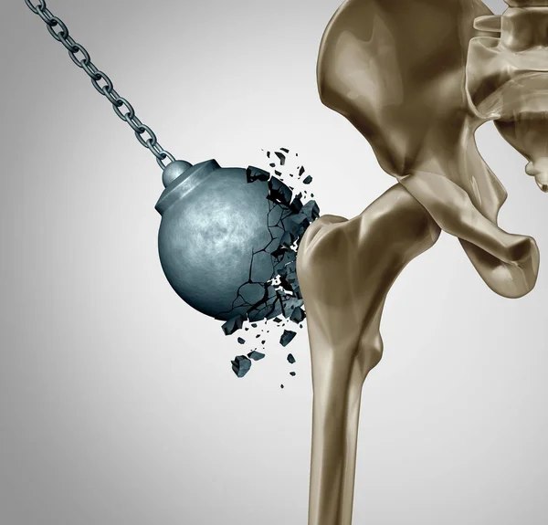 Starke Knochen Und Gesunde Menschliche Knochen Orthopädie Und Stärke Mineraldichte — Stockfoto