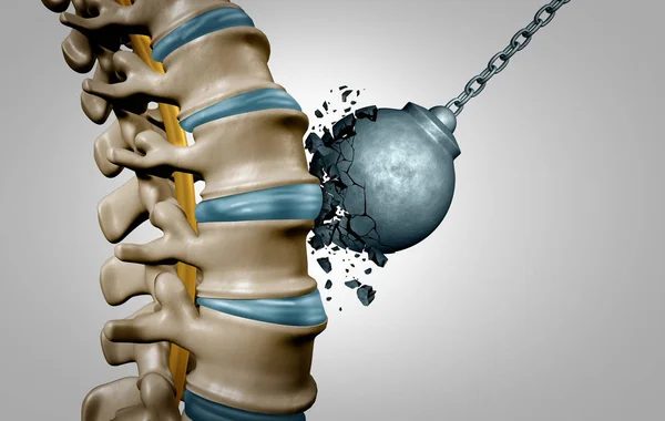 Strong spine and spinal strength human anatomy concept as medical health care body symbol with the skeletal bone structure and intervertebral discs closeup as a 3D illustration. — Stock Image Strong Spine Spinal Strength Human Anatomy Concept Medical Health Care Royalty Free Stock Photos