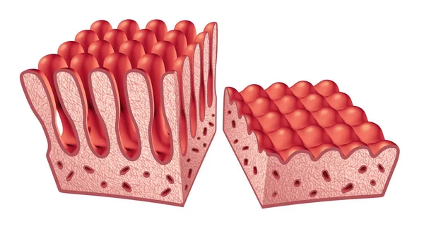 Anatomie Maladie Cœliaque Coeliaque Concept Médical Avec Villosités Normales Muqueuse — Photo