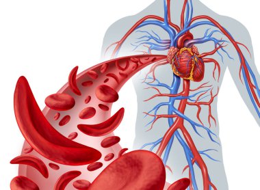 Sickle cell heart circulation and anemia as a disease with normal and abnormal hemoglobin in a human artery anatomy with heart cardiovascular medical illustration concept in a 3D render. clipart