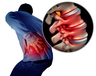Lower back pain or backache and painful spine medical concept as a person holding the painful spinal area as a medical concept with 3D illustration elements. clipart