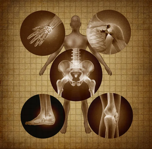 人間の関節痛や老化やグランジ テクスチャ Wth イラスト要素でスポーツや作業のけがのためのヘルスケアと医療症状体の痛み けがや関節炎病気のシンボルとしての解剖学の概念 — ストック写真