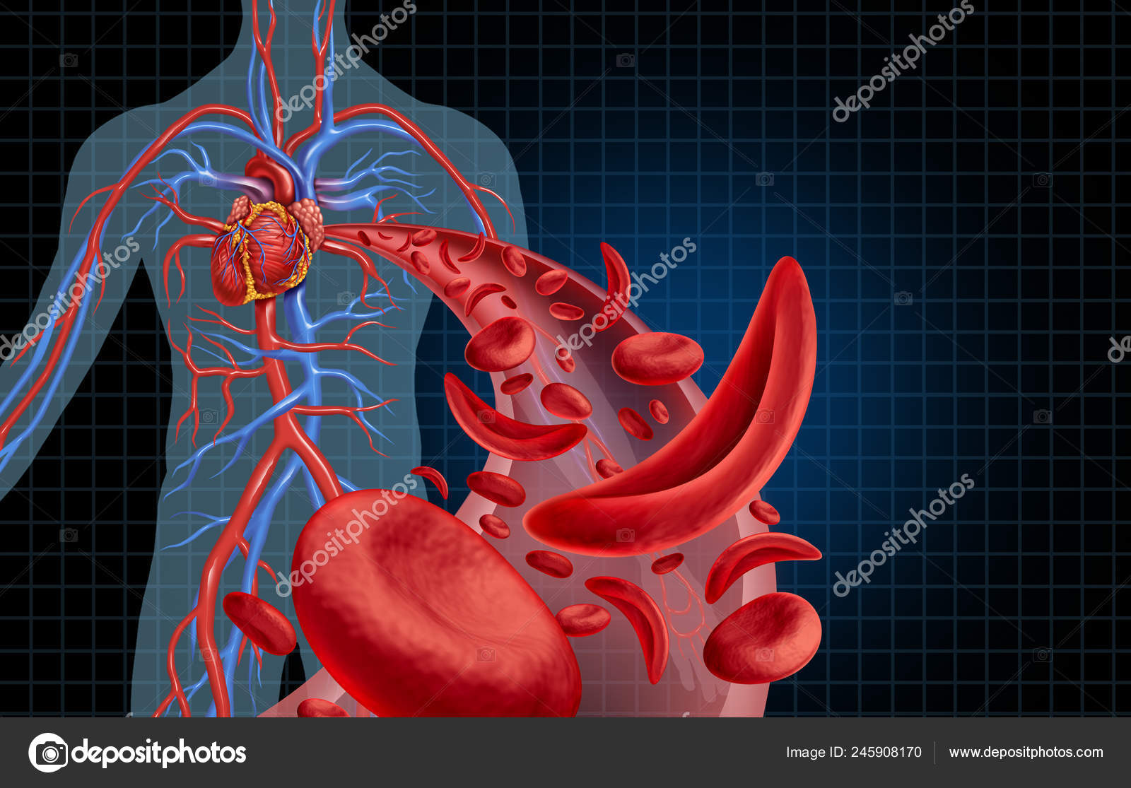 Sickle Cell Cardiovascular Heart Blood Circulation Anemia Disease Normal  Abnormal Stock Photo by ©lightsource 245908170