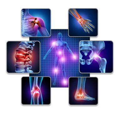 Human Body Joint Pain clipart