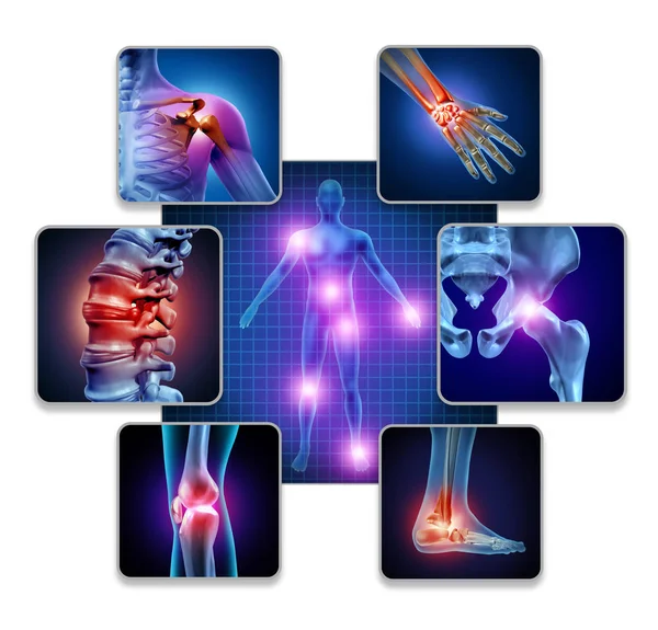 Human Body Joint Pain — Stock Photo, Image