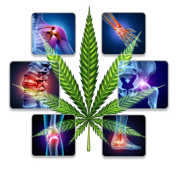Cannabis gegen Gelenkschmerzen — Stockfoto