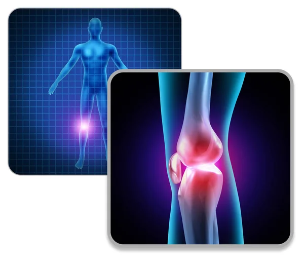 人間の膝の関節痛 — ストック写真