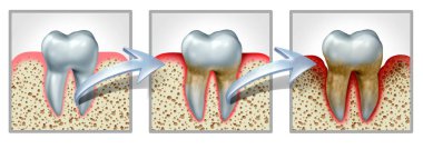 Tooth And Gums Disease clipart