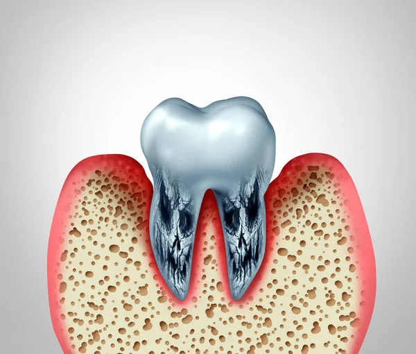 Dode Tanden Stervende Tanden Stomatologie Tandheelkundige Ziekte Slechte Mondhygiëne Gezondheidsprobleem — Stockfoto