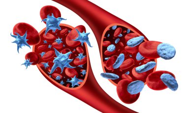 Platelet and non-activated platelets in the blood and thrombocyte anatomy concept as activated platelets flowing in an artery or vein as a 3D render. clipart