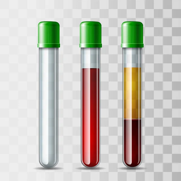 Set of glassware tube empty, filled blood and Fractioned blood in vitro, plasma and layers red blood cells.