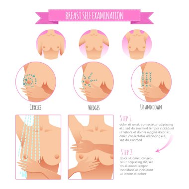 Meme kanseri bilinçlendirme Infographic