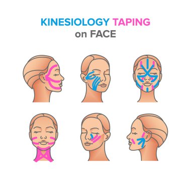 kinesiyoloji yüz üzerinde çizimler taping