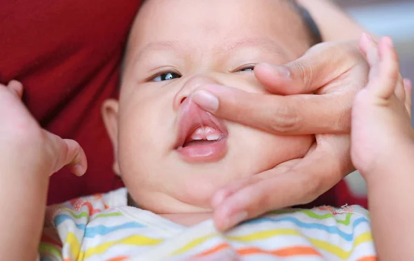 Руки Матери Крупным Планом Открывают Рот Младенца Осмотреть Первые Зубы — стоковое фото