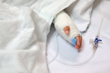 Bebek el hastanın yatakta intravenöz serum fizyolojik ile hastaneye kapatın. Bebek hastanede itiraf etti. Çocuk hastalarda IV tüp var.