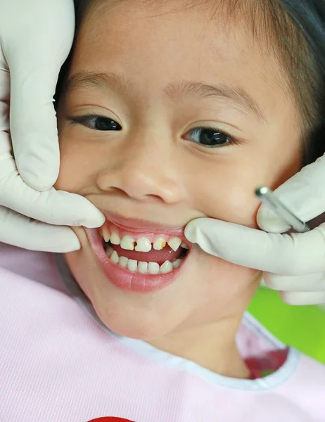 Ragazzina Primo Piano Durante Estrazione Dentale Bambino Con Denti Rotti — Foto Stock