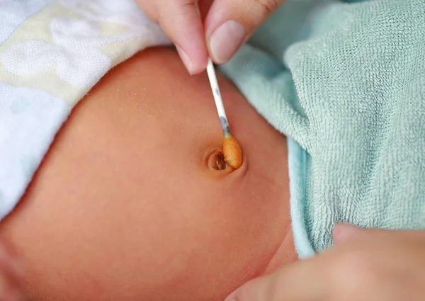 Plaquette Thermoformee Du Vaccin Bacille Calmette Guerin g Sur L Epaule Du Bebe Maladie Caucasien Stock Photo Plaquette Thermoformee Du Vaccin Bacille Calmette Guerin g Sur L Epaule Du Bebe Maladie Caucasien Stock Photo