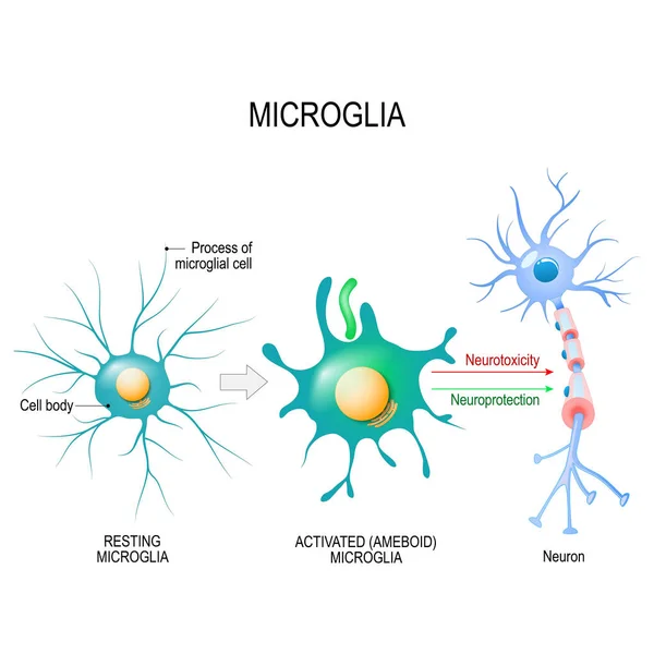 Aktivierung Einer Mikrogliazelle Vektordiagramm Für Pädagogische Medizinische Biologische Und Wissenschaftliche — Stockvektor