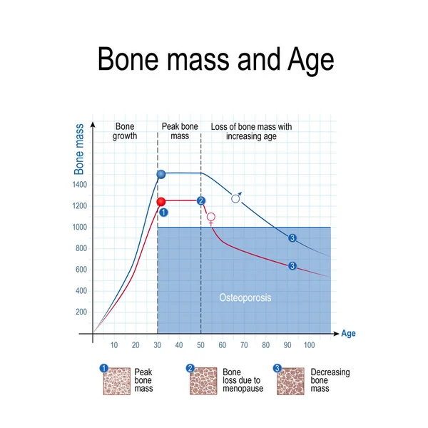男性和女性的骨量 年龄和骨质疏松症 健康的生活方式 传染媒介例证为教育 科学和医疗用途 — 图库矢量图片