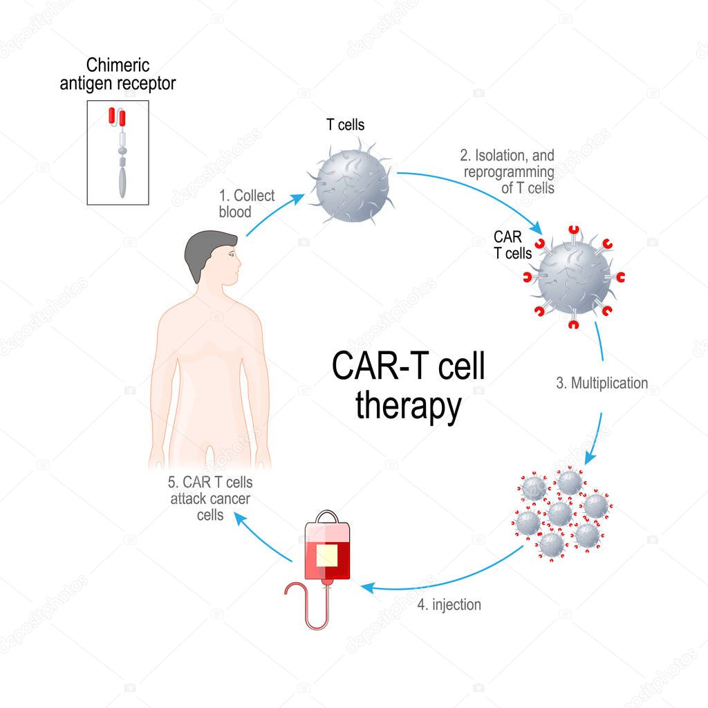 CAR T cell therapy. cancer immunotherapy. Artificial leukocyte r