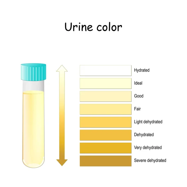 Color de orina. Tabla para evaluar la hidratación y la deshidratación. Pis. — Archivo Imágenes Vectoriales