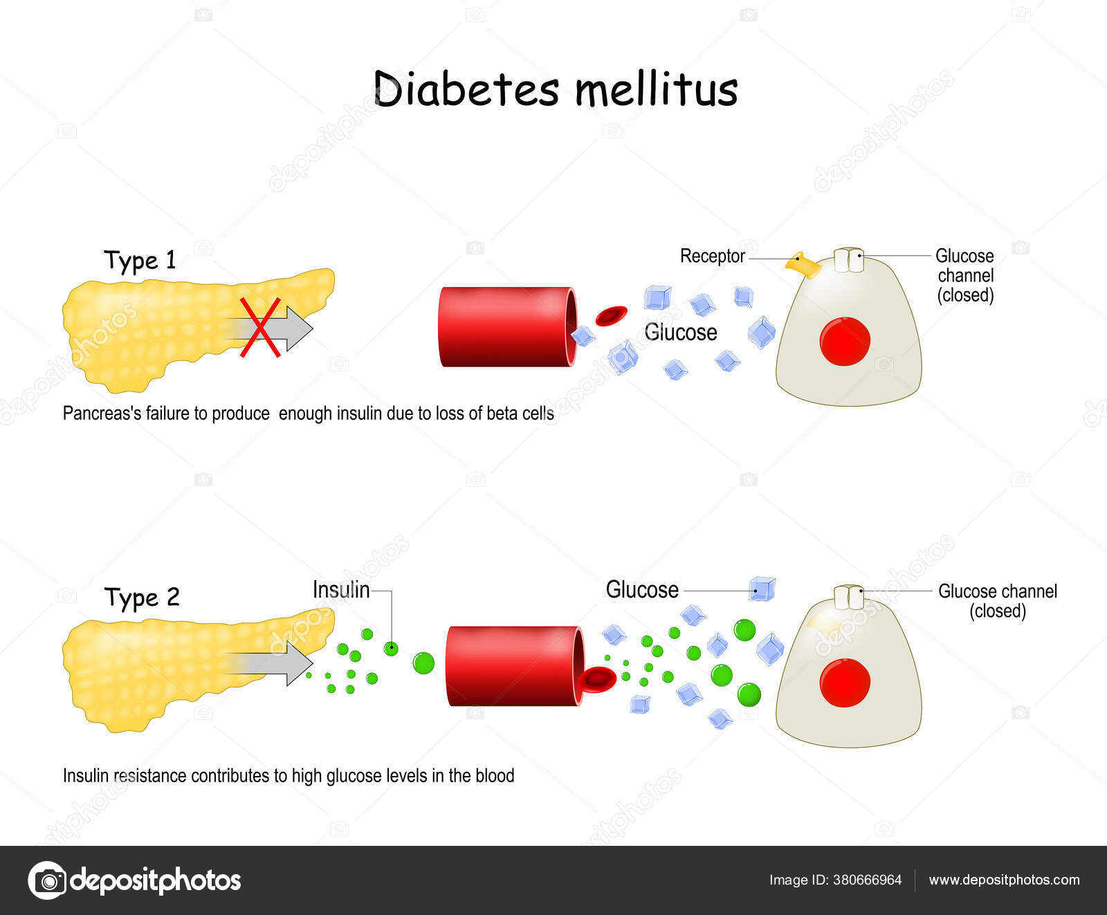 diabetes májkezelés cukorbetegség vese szövődmény kezelésére