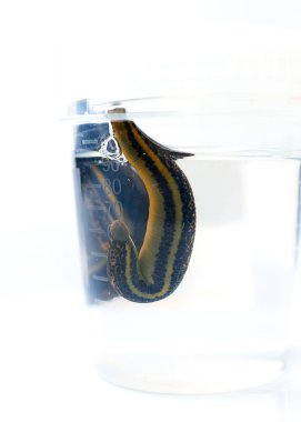 Hiroterapi. Tıbbi sülükler sudaki bardakta.