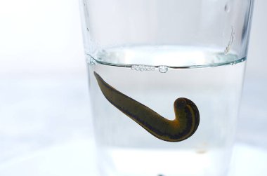 Hiroterapi. Tıbbi sülükler sudaki bardakta.