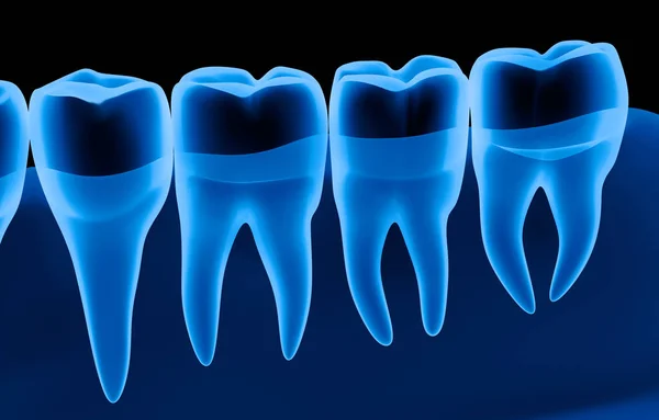 Escaneo Dental Transparente Vista Rayos Ilustración —  Fotos de Stock