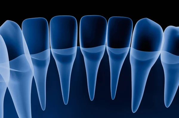 Escaneo Dental Transparente Vista Rayos Ilustración —  Fotos de Stock